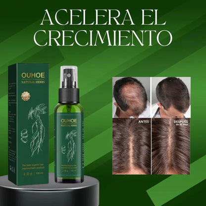 Ouhoe™ Elixir Capilar, recuperar el crecimiento natural, detener la caída (tamaño XL 100ml)